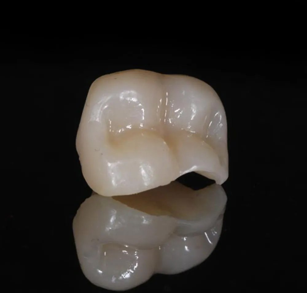 Endo Restoratif