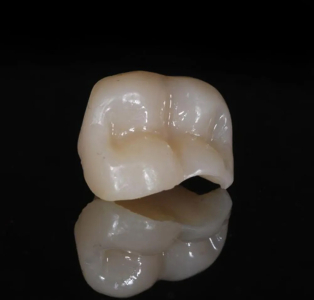 Endo Restoratif