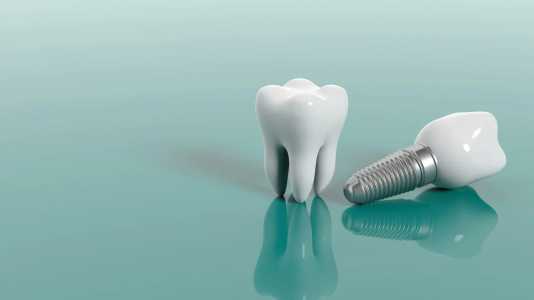 Dental İmplant